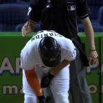 MLB HR leader Stanton has broken bone in hand
